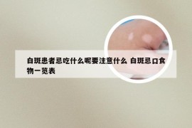 白斑患者忌吃什么呢要注意什么 白斑忌口食物一览表