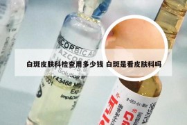 白斑皮肤科检查用多少钱 白斑是看皮肤科吗