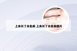 上身长了白色癣 上身长了白色癣图片