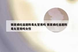 银屑病吃连翘败毒丸管用吗 银屑病吃连翘败毒丸管用吗女性