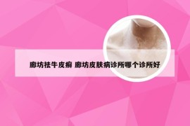 廊坊祛牛皮癣 廊坊皮肤病诊所哪个诊所好