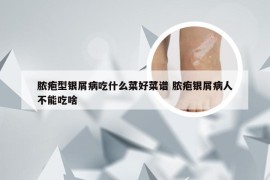 脓疱型银屑病吃什么菜好菜谱 脓疱银屑病人不能吃啥