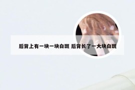 后背上有一块一块白斑 后背长了一大块白斑