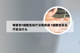 哪里有t细胞免疫疗法银屑病 t细胞免疫治疗能治什么