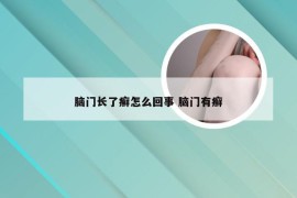 脑门长了癣怎么回事 脑门有癣