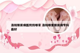 洛阳银屑病医院找哪家 洛阳哪里银屑病专科最好