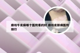 廊坊牛皮癣哪个医院看的好 廊坊皮肤病医院排行