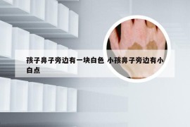 孩子鼻子旁边有一块白色 小孩鼻子旁边有小白点