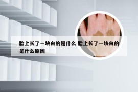 脸上长了一块白的是什么 脸上长了一块白的是什么原因