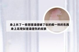 身上长了一些想搓澡搓破了似的癣一样的东西 身上出现似搓澡搓伤的皮肤