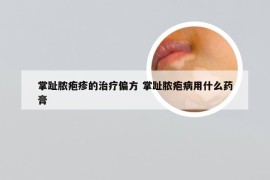 掌趾脓疱疹的治疗偏方 掌趾脓疱病用什么药膏