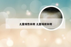 儿童线性白斑 儿童线状白斑