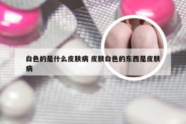 白色的是什么皮肤病 皮肤白色的东西是皮肤病