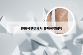 体癣可以拔罐吗 体癣可以挠吗