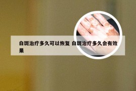 白斑治疗多久可以恢复 白斑治疗多久会有效果