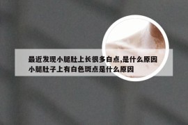 最近发现小腿肚上长很多白点,是什么原因 小腿肚子上有白色斑点是什么原因