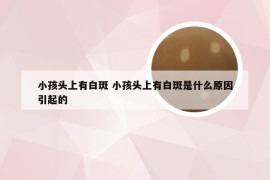 小孩头上有白斑 小孩头上有白斑是什么原因引起的