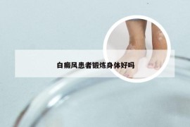 白癜风患者锻炼身体好吗