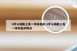 6岁小孩脸上有一块白色的 6岁小孩脸上有一块白色的斑点