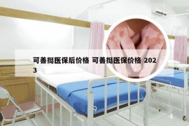 可善挺医保后价格 可善挺医保价格 2023