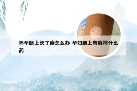 怀孕腿上长了癣怎么办 孕妇腿上有癣擦什么药