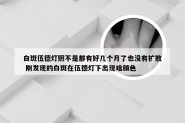 白斑伍德灯照不是都有好几个月了也没有扩散 刚发现的白斑在伍德灯下出现啥颜色