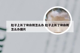 肚子上长了块白斑怎么办 肚子上长了块白斑怎么办图片