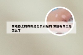 生殖器上的白斑是怎么引起的 生殖有白斑是怎么了