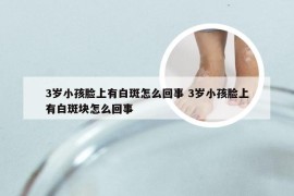 3岁小孩脸上有白斑怎么回事 3岁小孩脸上有白斑块怎么回事