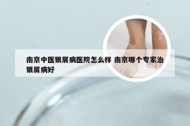 南京中医银屑病医院怎么样 南京哪个专家治银屑病好