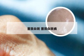 蔷薇白斑 蔷薇白斑病