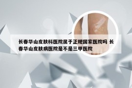 长春华山皮肤科医院属于正规国家医院吗 长春华山皮肤病医院是不是三甲医院