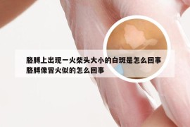 胳膊上出现一火柴头大小的白斑是怎么回事 胳膊像冒火似的怎么回事