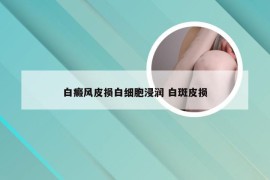 白癜风皮损白细胞浸润 白斑皮损