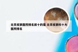 北京皮肤医院排名前十的是 北京皮肤科十大医院排名