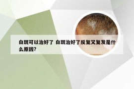 白斑可以治好了 白斑治好了反复又复发是什么原因?