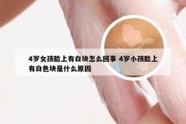 4岁女孩脸上有白块怎么回事 4岁小孩脸上有白色块是什么原因