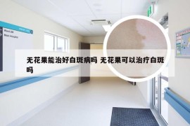 无花果能治好白斑病吗 无花果可以治疗白斑吗