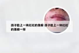 孩子脸上一块红红的像癣 孩子脸上一块红红的像癣一样