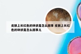 皮肤上长红色的块状是怎么回事 皮肤上长红色的块状是怎么回事儿