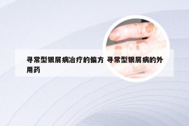 寻常型银屑病冶疗的偏方 寻常型银屑病的外用药