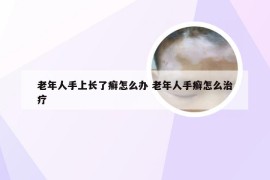 老年人手上长了癣怎么办 老年人手癣怎么治疗