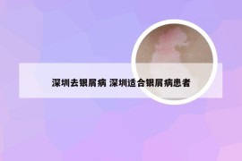 深圳去银屑病 深圳适合银屑病患者