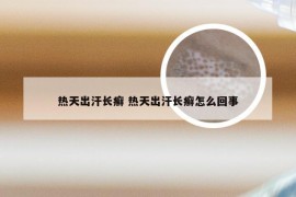 热天出汗长癣 热天出汗长癣怎么回事