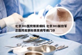 北京301医院银屑病科 北京301解放军总医院皮肤科银屑病专病门诊