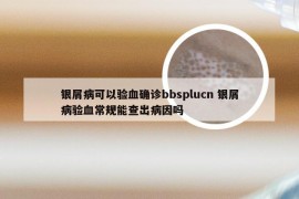 银屑病可以验血确诊bbsplucn 银屑病验血常规能查出病因吗