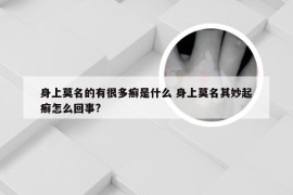 身上莫名的有很多癣是什么 身上莫名其妙起癣怎么回事?