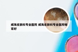 威海皮肤科专业医院 威海皮肤科专业医院哪家好