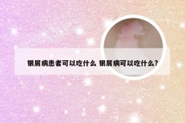 银屑病患者可以吃什么 银屑病可以吃什么?