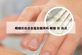 眼睛长白点会是白癜风吗 眼睛 长 白点